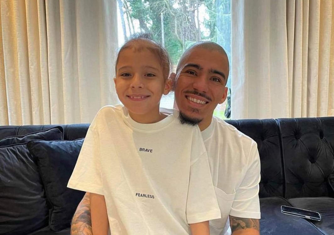 Il figlio ha l’alopecia: Allan si rasa a zero per essere come lui