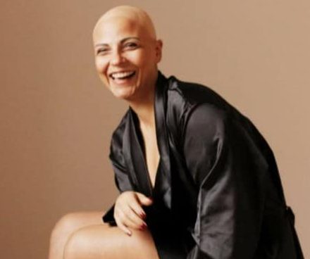 “Non sanno cosa è l’alopecia, da piccola ho vissuto un inferno”: la testimonianza di Giovanna Russo
