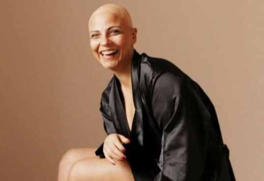 “Non sanno cosa è l’alopecia, da piccola ho vissuto un inferno”: la testimonianza di Giovanna Russo