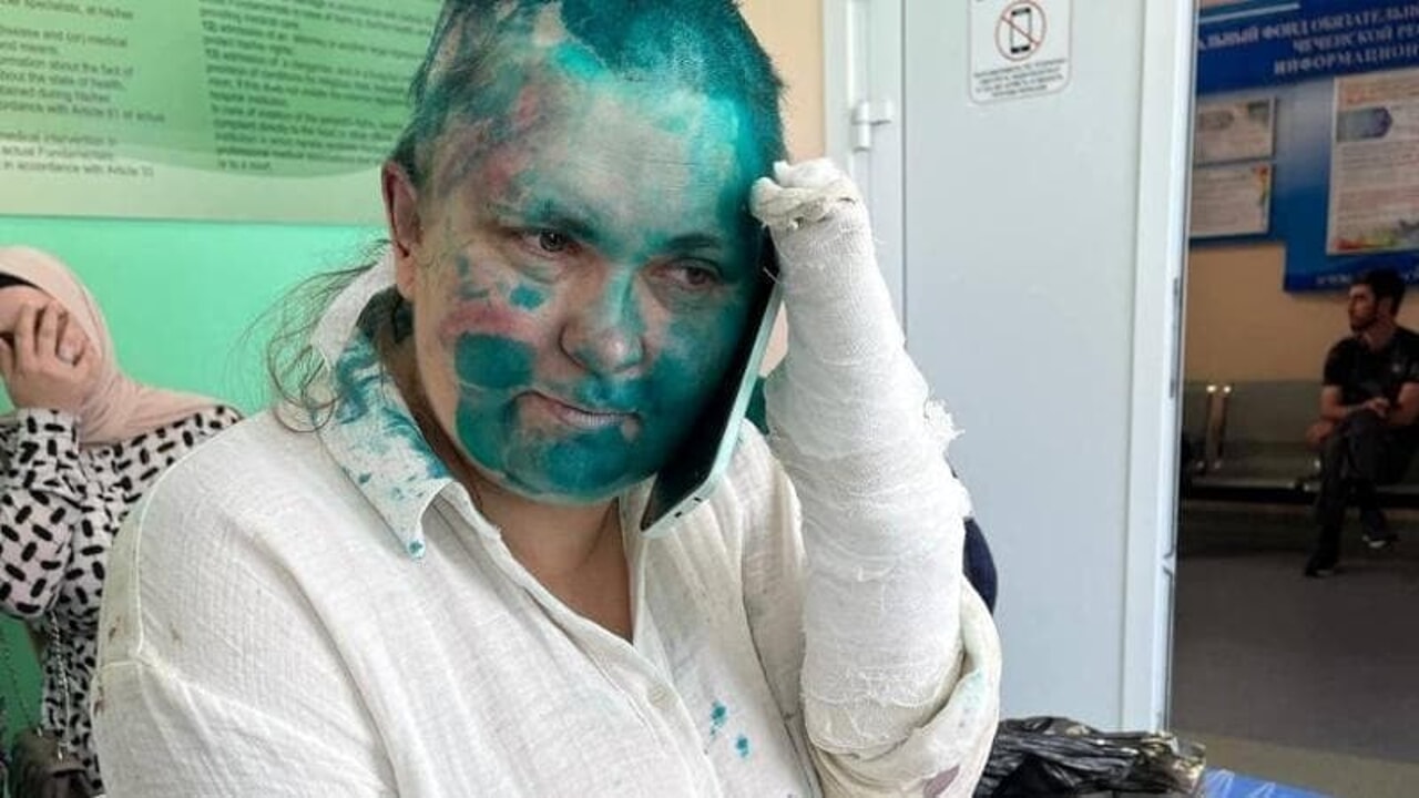 Orrore in Russia: giornalista picchiata, rasata e colpita con liquido colorato